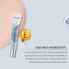 Moisturizing Eye Cream Moisturizes The Skin Around The Eyes With Elastic Massage And Moisturizes The Delicate Skin Firming And Smoothing Eye Cream