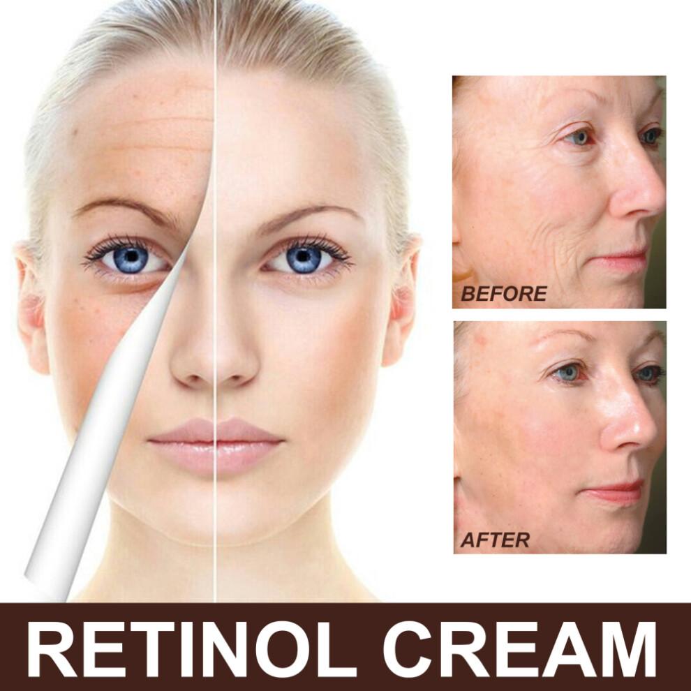 2X Retinol Cream with Hyaluronic Acid & Vitamin C - Anti-Aging, Brightening & Firming Moisturiser for All Skin Types