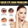 Remove Eye Bags Eye Cream Retinol Cream Anti-Puffiness Gel Dark Circles Delay Aging Reduce Wrinkles Eye Cream