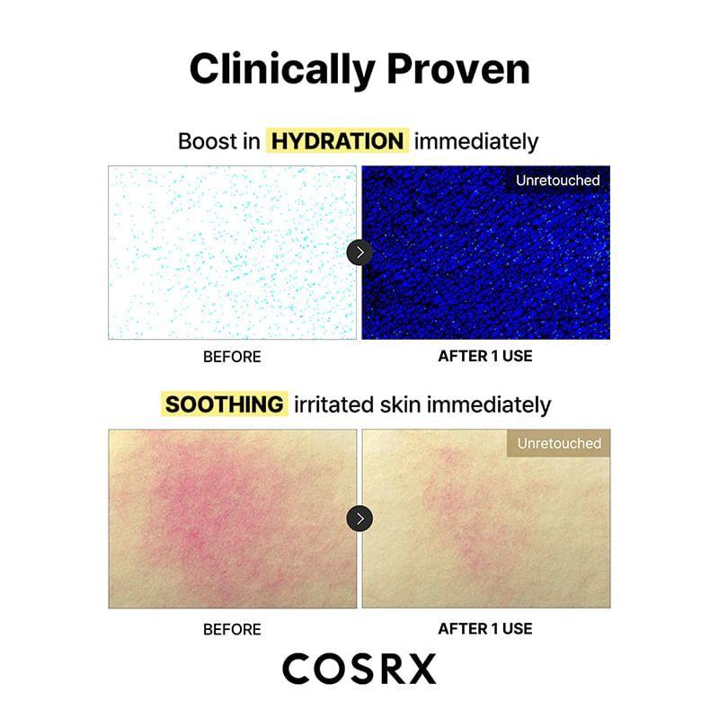 COSRX - Advanced Snail Mucin Glass Glow Hydrogel Mask Set