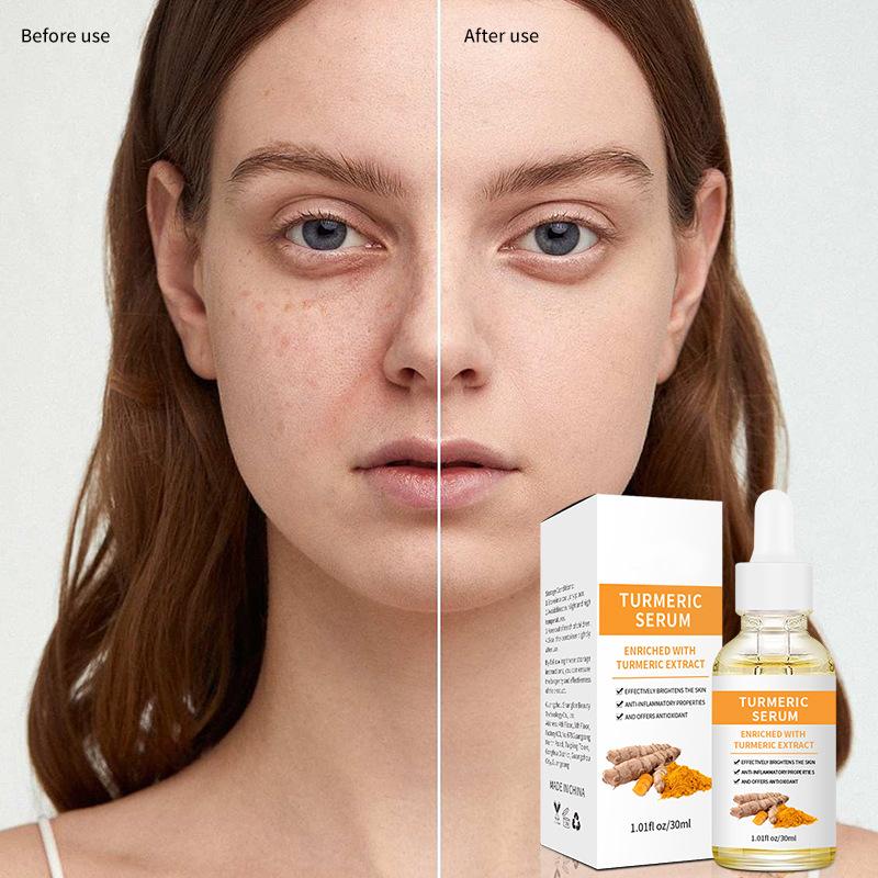 Куркума сыворотка для лица увлажняющая осветляющая веснушки разглаживающая морщины эссенция для кожи