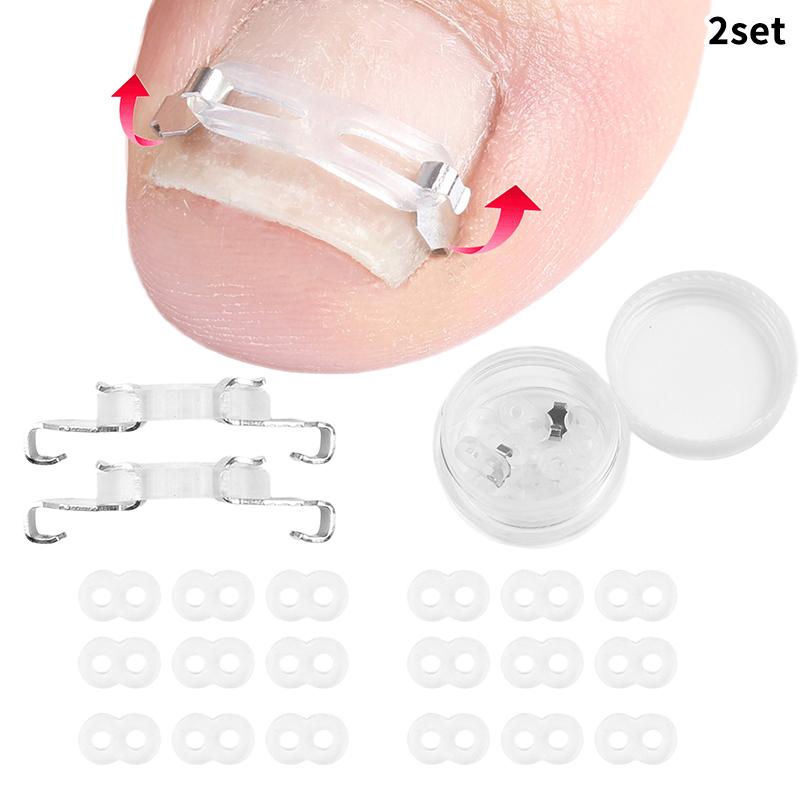 1/2 Набор Инструменты для коррекции вросшего ногтя педикюр восстановление лечение вросшего ногтя профессиональный инструмент для ухода за ногами