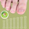 10 шт., коррекция вросшего ногтя, выпрямляющий зажим для педикюра