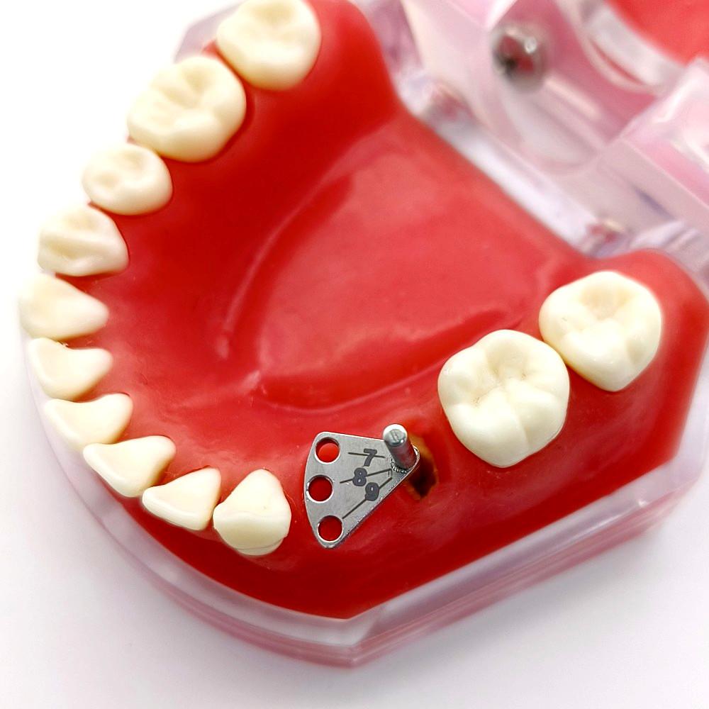 Зубной имплантат. Калибр с параллельными штифтами. Лакатор из нержавеющей стали. Направляющая для локации зубного имплантата. Локационная линейка.