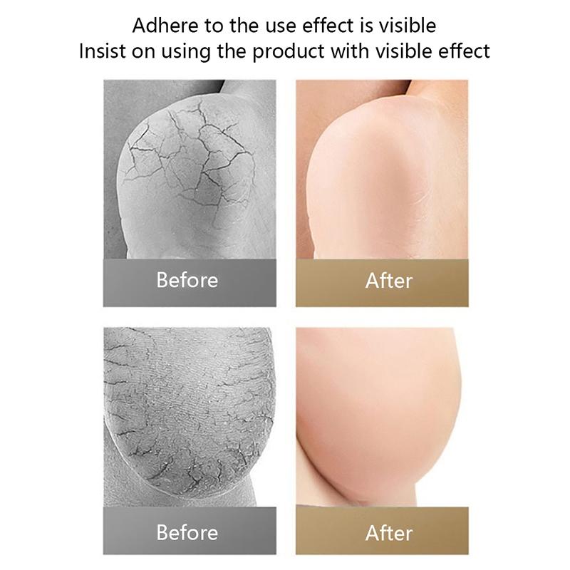 1Pair Gel Silicone Heel Protector Sleeve Heel Pads Heel Cups Plantar Support