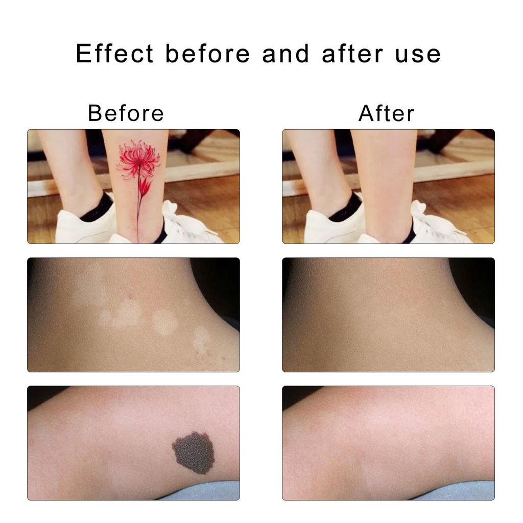 6 листов водонепроницаемой маскирующей ленты для кожи, наклейки для маскировки татуированных изъянов, наклейки для маскировки изъянов шрамов для свадеб