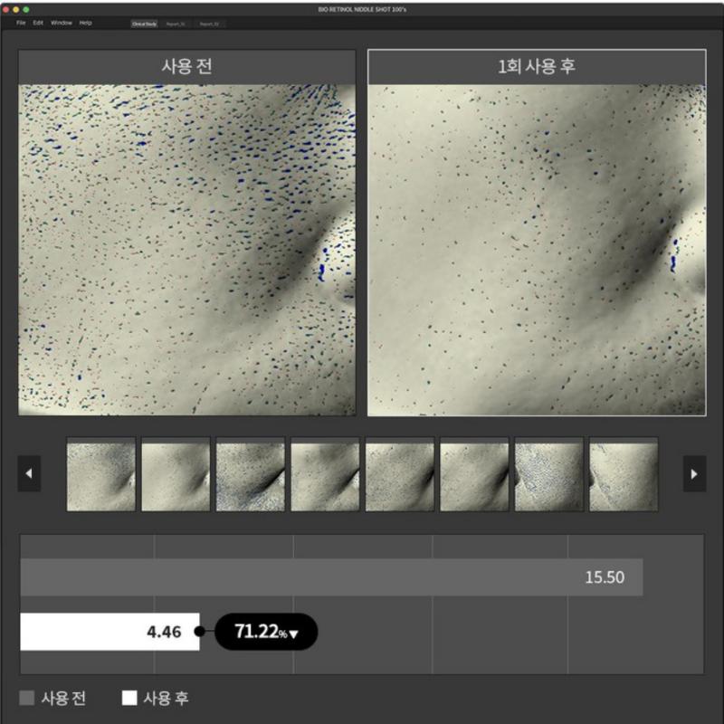 [NU Cosmetic] Био-ретиноловая игольная эссенция 100 выстрелов улучшает текстуру кожи сужает поры стволовые клетки 50 мл