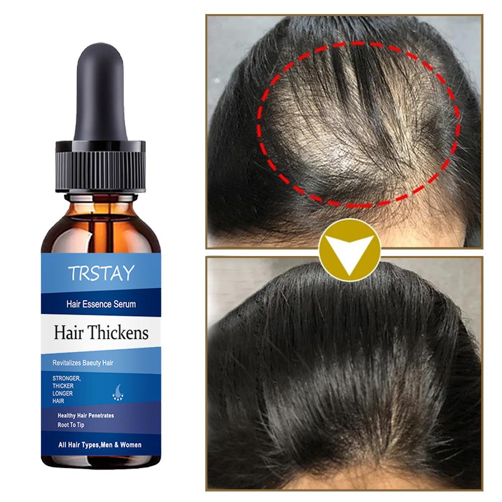 Black Women Hair Growth Oil Essential Oils Liquid Anti Hair Loss Baldness Remedy Boost Grow Thicker Hair Care Scalp Treatment
