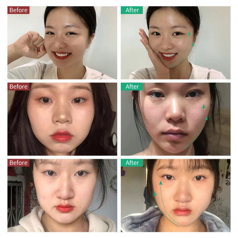 Устройство для лифтинга лица, светодиодная фотонная терапия, вибрационный массажер для похудения, двойной подбородок, V-образная подтяжка щек, лицо