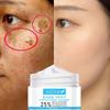 30ml Dark Spot Cream Multi-Intense Fade Melanin Natural Extract Effective Pigment Removing Cream for Beauty