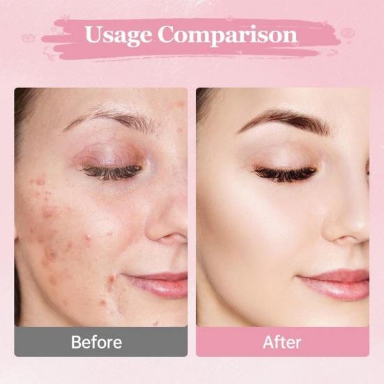 40 шт. очищающих дисков с койевой кислотой для удаления темных пятен и макияжа, спрессованные спонжи для лица с куркумой, мягкое очищение пор, отшелушивание, очистка лица, хлопок