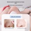 Blackhead Remover Tool: Manual Acne Extractor & Comedone Picker for Nose Cleaning