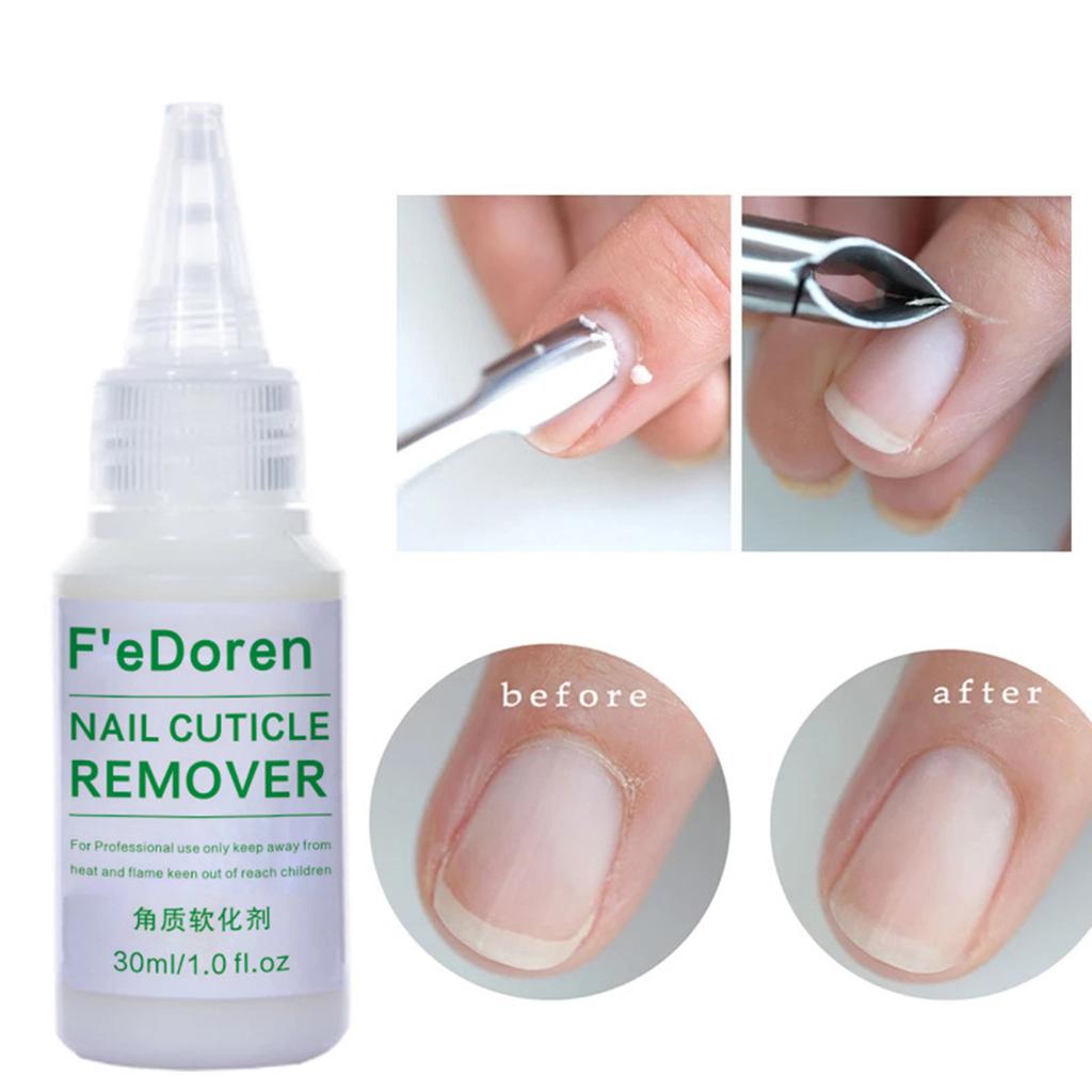 Eco-friendly Dead Skin Remover Excellent Effective Remove Dead-Skin Nail Care Growth Treatment Oil