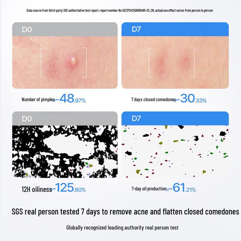 Hi!papa Double Extract Oil Control Repair Essence Water