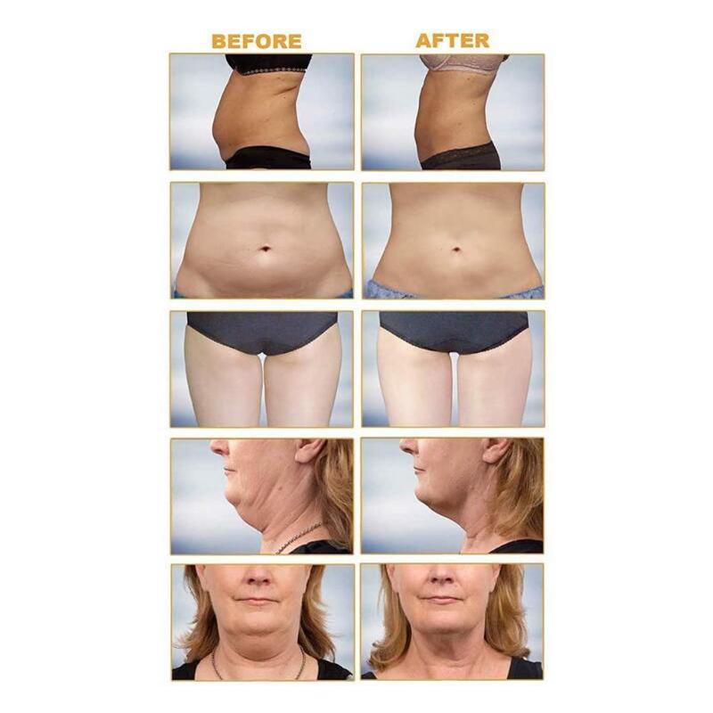 5 In 1 Vacuum Ultrasonic Cavitation Radio Frequency Multipolar RF Body Slimming Machine Skin Lifting Tighten Anti-Wrinkle Device