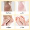 Отшелушивающий крем для ног Массажный крем для ног Отшелушивающий омертвевшую кожу Увлажняющий уход за ногами Питательный крем для ухода за ногами