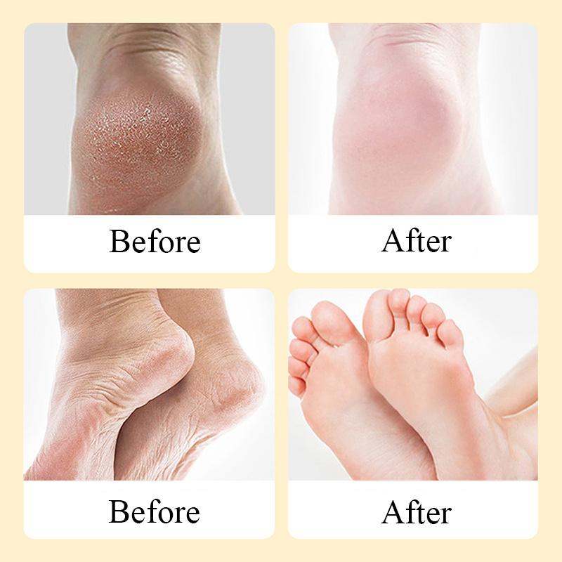 Отшелушивающий крем для ног Массажный крем для ног Отшелушивающий омертвевшую кожу Увлажняющий уход за ногами Питательный крем для ухода за ногами