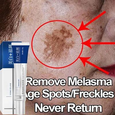 Эффективный отбеливающий крем от веснушек, удаление мелазмы, темных пятен, устранение пигментации, увлажнение, осветление кожи лица, средство по уходу за кожей