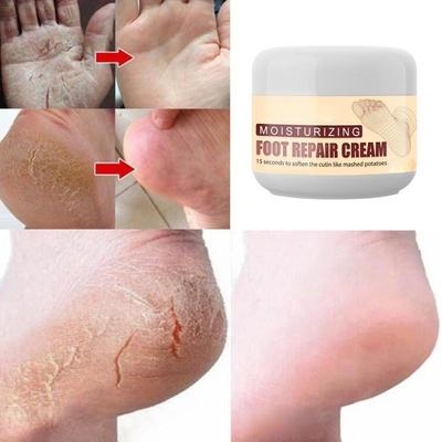 Foot Repair Cream Увлажняющий и восстанавливающий крем для ухода за ногами, шелушением пяток
