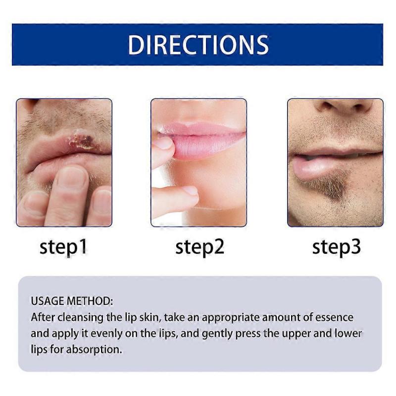 Lip Essence Ball Liquid Moisturizing Fade Lip Lines Anti-Chapping Dead Skin Plump Lip Moisturizing,1-3pcs