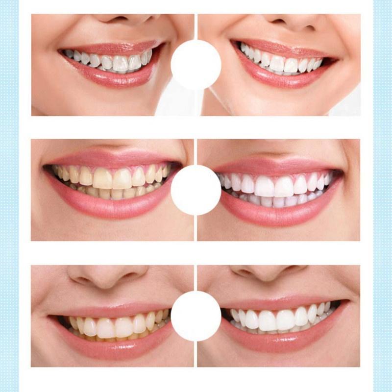 Новая ручка для отбеливания зубов, гель для отбеливания зубов, отбеливатель, удаление пятен, мгновенная улыбка, набор для отбеливания зубов, чистящая сыворотка, красота, здоровье