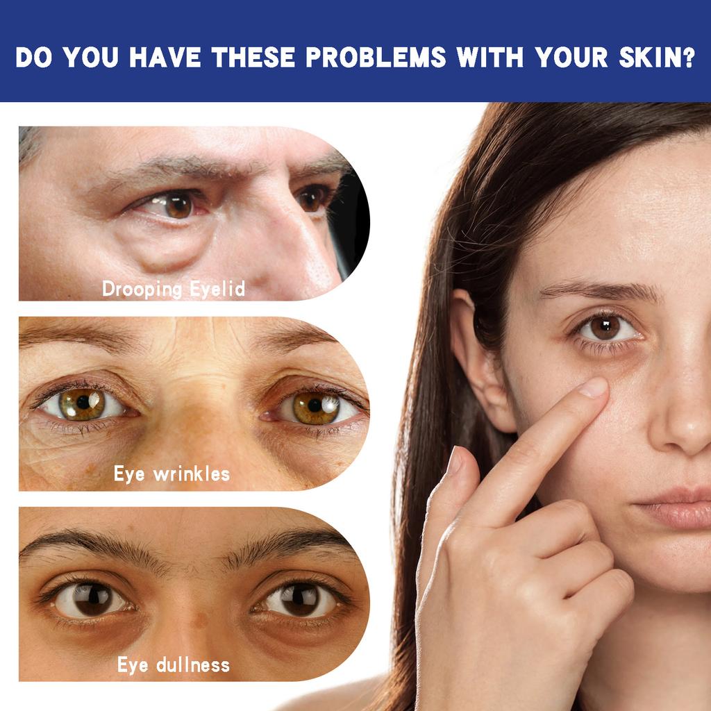 Firming Eye Cream To Lighten Fine Lines At the Corners of the Eyes, Repair Dark Circles On the Skin Around the Eyes, and Provide Eye Care