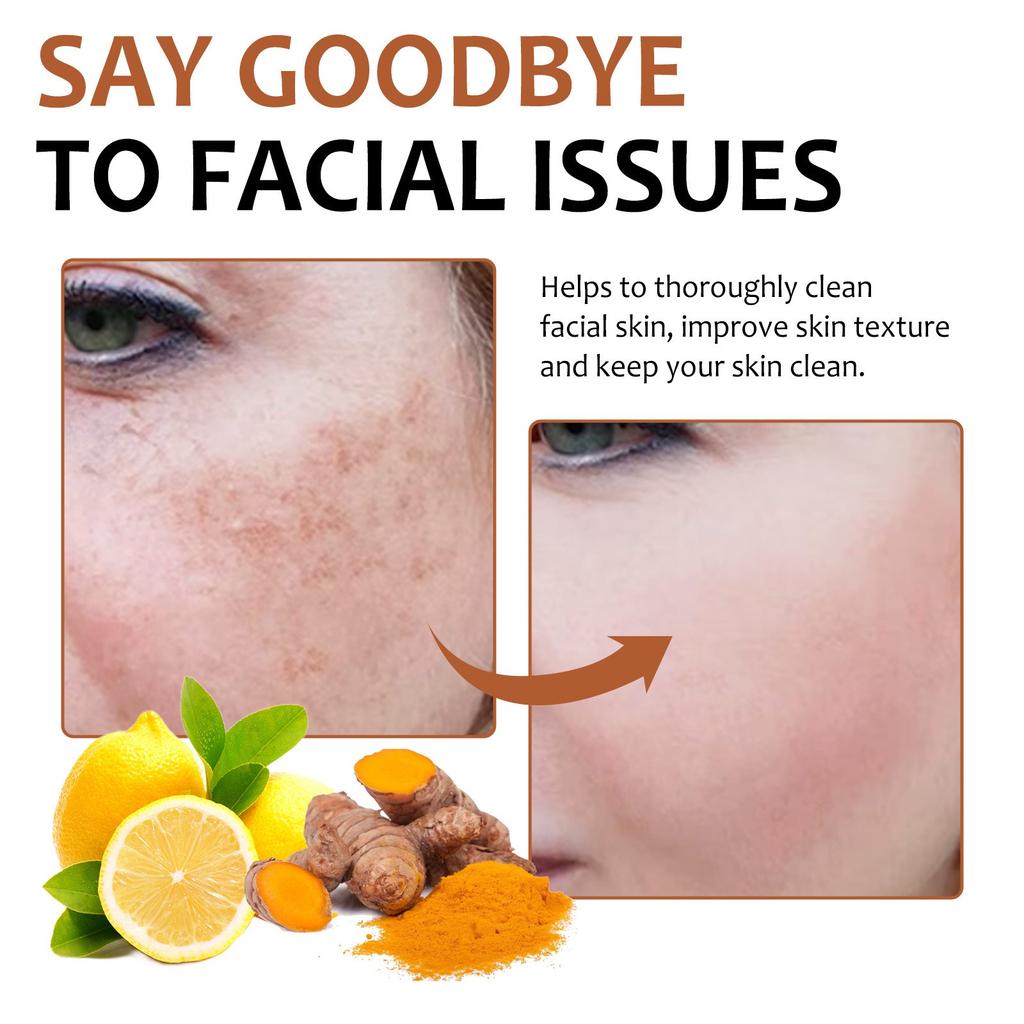 Lemon Kojic Soap Kojic Soap For Hyperpigmentation For Dark Dot Kojic  Dark Dot Remover Soap Face Body Wash Hand Bath Soap Bars Face Cleanser 100g