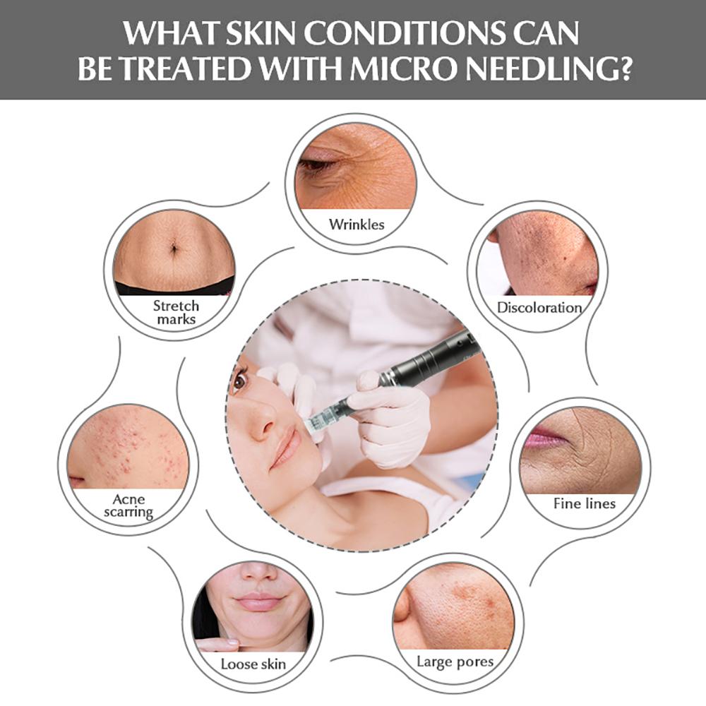 Dr.Pen M8W Перезаряжаемая ручка с микроиглами для мезотерапии, набор для ухода за кожей с 12 шт. картриджами, роликами для дермы, MTS, профессиональное устройство для салона красоты