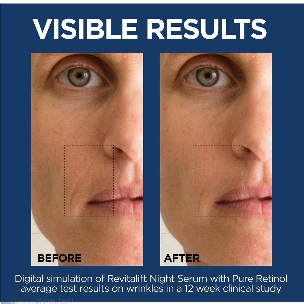 L Or aL revitaLift Derm Intensives Ночная сыворотка с 0,3% чистого ретино 1,0 унции