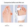 Thumb Eversion Orthotic Device Toe Separator Bunion Corrector With Anti-Slip Heel Strap Adjustable Orthotic Knob Buckle
