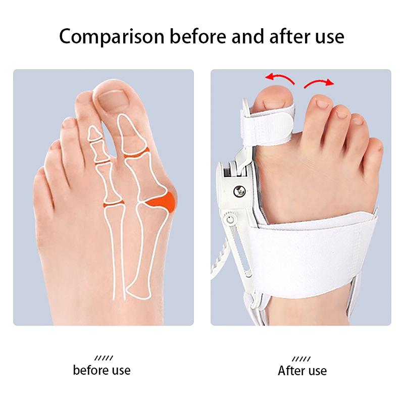 Thumb Eversion Orthotic Device Toe Separator Bunion Corrector With Anti-Slip Heel Strap Adjustable Orthotic Knob Buckle