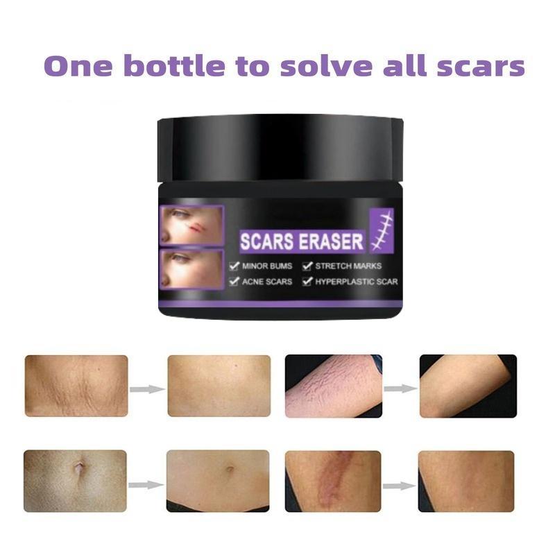 Крем для восстановления рубцов, обессоливание послеоперационных шрамов, гладкая кожа, восстановление кожных ран, увлажняющий крем для ухода за кожей