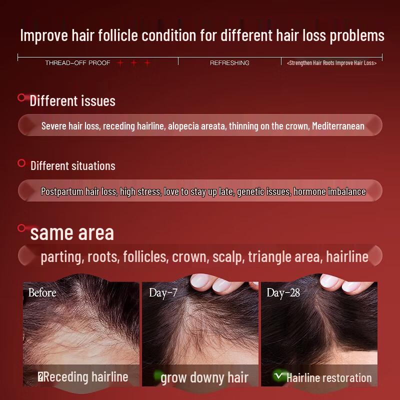 vetes Эссенция для кожи головы против выпадения волос и для роста волос