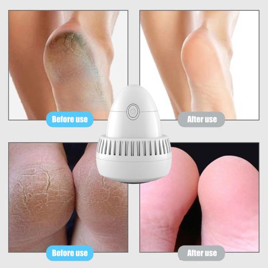 Electric Foot Grinder Effective Callus Removal Foot Repair Tool Multifunctional Massage Heel Cuticle Grinding Foot Grinder for Soft Smooth Feet