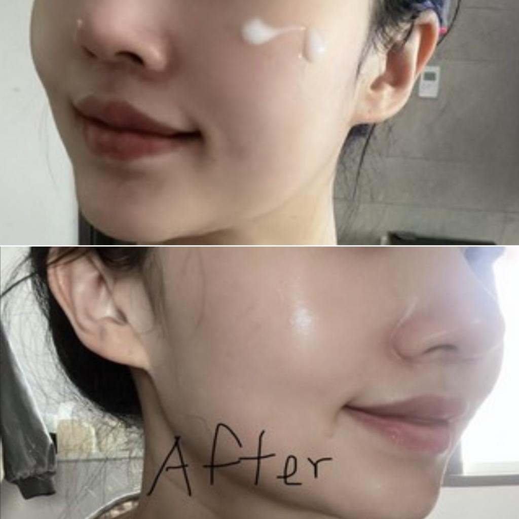 [NU Cosmetic] Ретиноловая игольчатая эссенция 300 выстрелов 50 мл