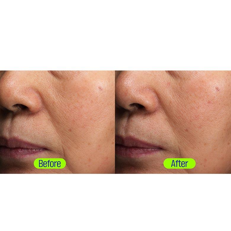 FATION Mela Zero Dark Spot Toning Ampoule 32 мл