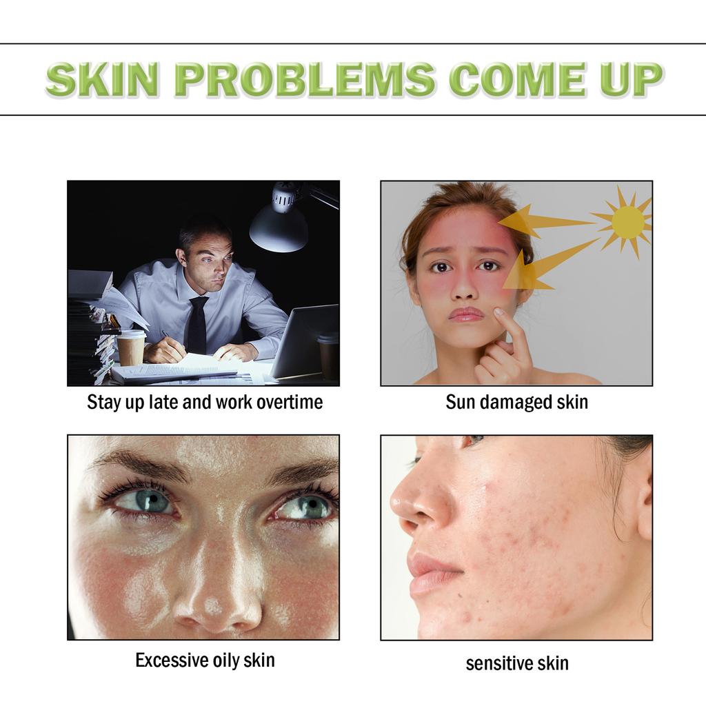 EELHOE Tea Tree Acne Repair Essence Осветляет следы от прыщей Очищает прыщи Устраняет прыщи Восстанавливает кожу Увлажняющая эссенция