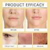 Hoygi Bee Venom Facial Firming Cream Collagen Boosting Anti Wrinkle Lifting Treatment for Sagging Skin And Fine Lines