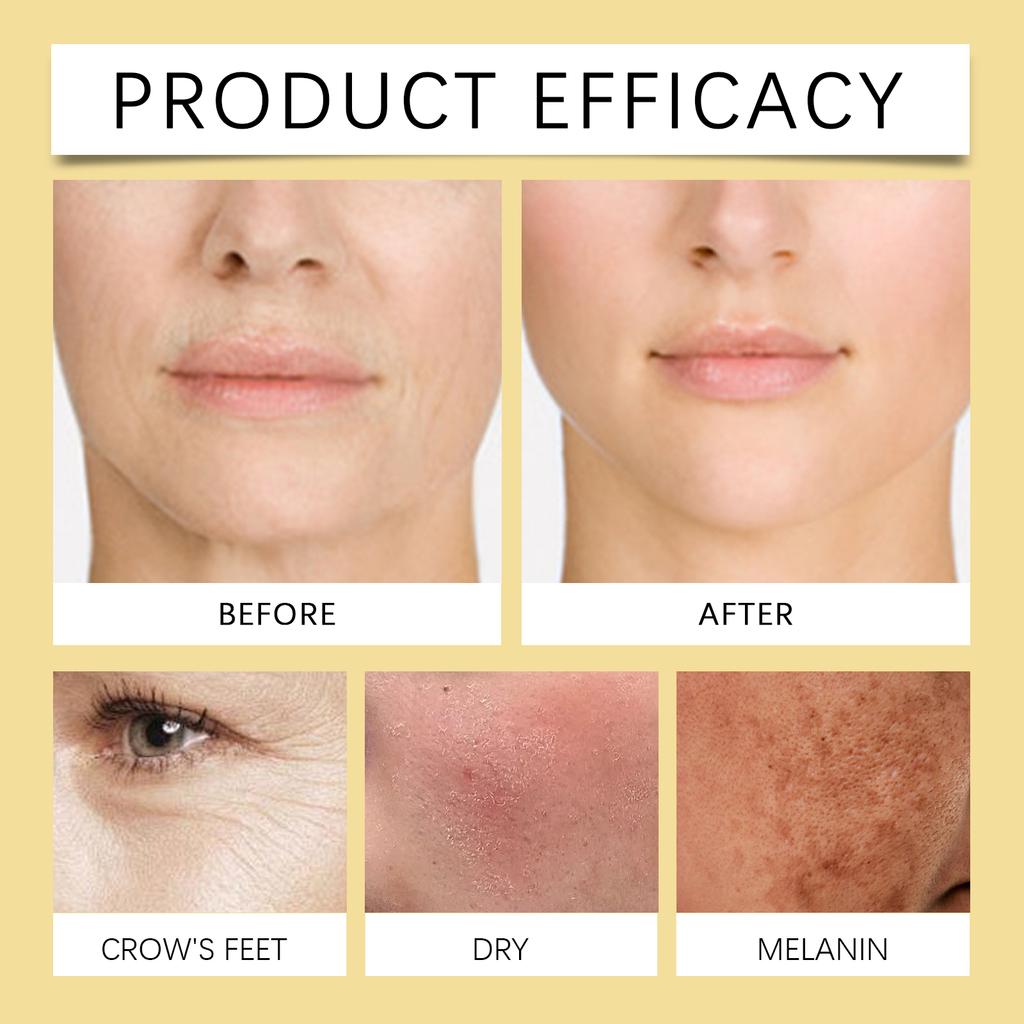 Hoygi Bee Venom Facial Firming Cream Collagen Boosting Anti Wrinkle Lifting Treatment for Sagging Skin And Fine Lines