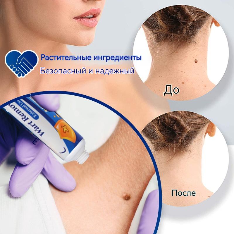 Мазь для удаления родинок ZB с коллагеном для ежедневного ухода за кожей и растворения бородавок