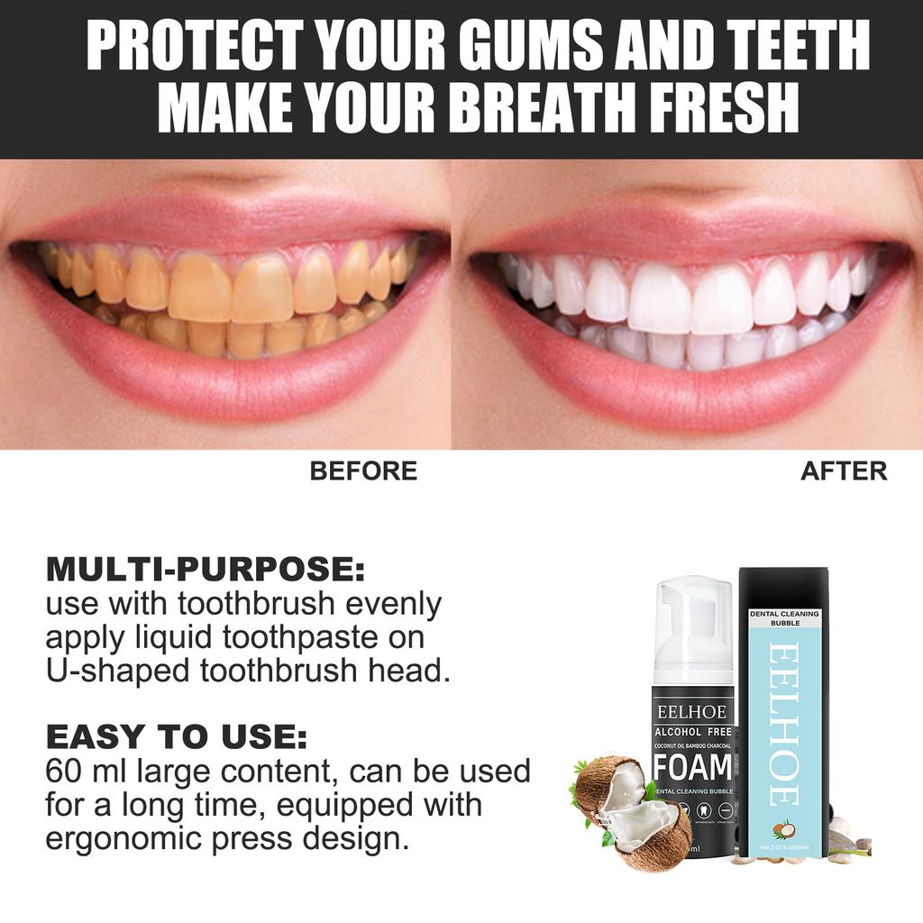 EELHOE Пенная зубная паста для удаления пятен на зубах, чистка рта, зубная паста, отбеливающий мусс, зубная паста, уход за пятнами, зубная паста для десен, 60 мл