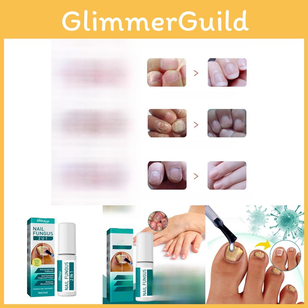 Премиальное средство для восстановления ногтей на ногах 5 мл Для обесцвеченных ногтей и смягчения ногтей