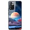 Tempered Glass Case For Xiaomi Redmi Note 11 Pro+ 5G Cover Hard Protective Funda for Redmi Note 11 Pro Plus 5G Luxury 6.67 inch