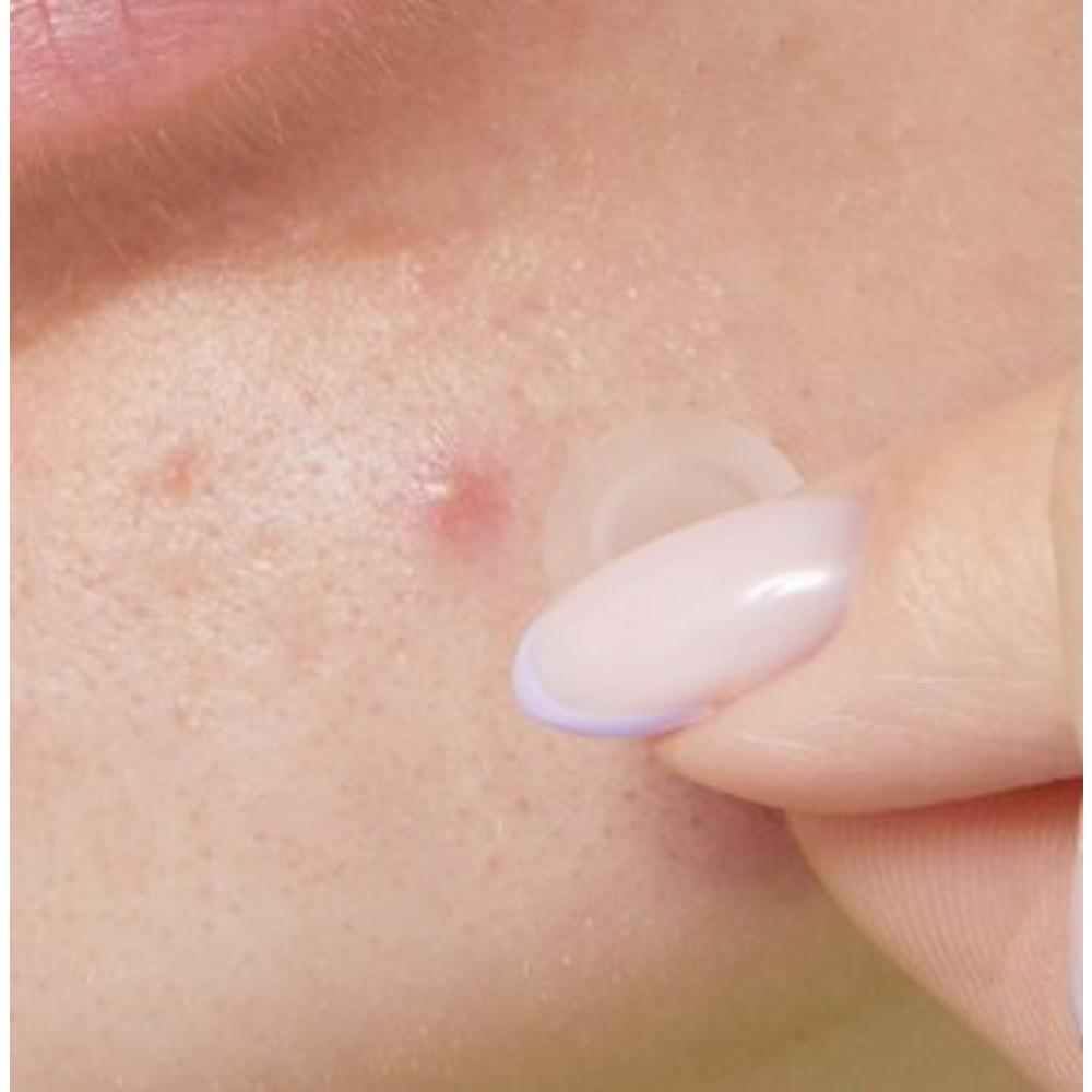 Пластырь для проблемной кожи Idewcare Time Out Blemish Patch Plus, 36 шт., 1 шт.