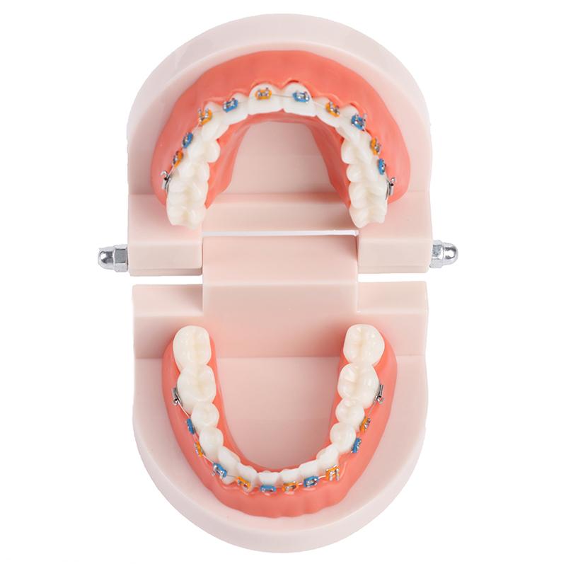 Зубоврачебная ортодонтическая модель зубов с учебным оборудованием школы металлических брекетов