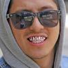 SHOP-STORY - Набор зубов в стиле хип-хоп Grillz - Розовое золото