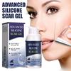 Scar Gel Acne Spots Removal Stretch Marks Burn Reduces Appearance Of Old & New Whitening
