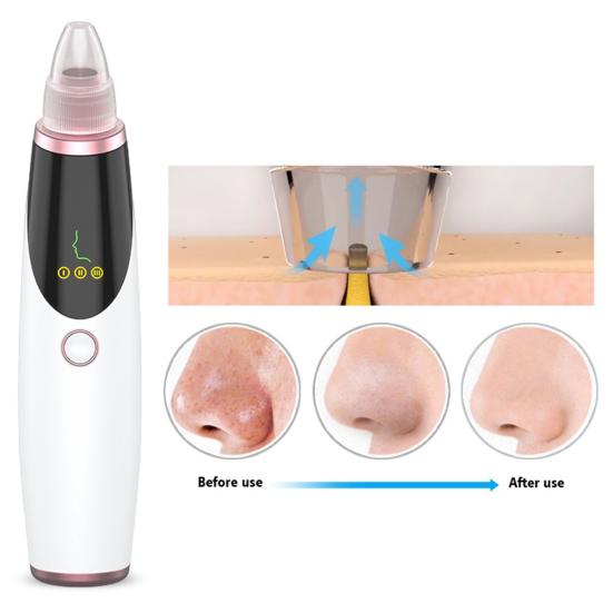 Электрический прибор для удаления черных точек, портативный вакуумный инструмент для удаления черных точек с 5 всасывающими головками, 3 режима регулировки, подарок для женщин и девочек