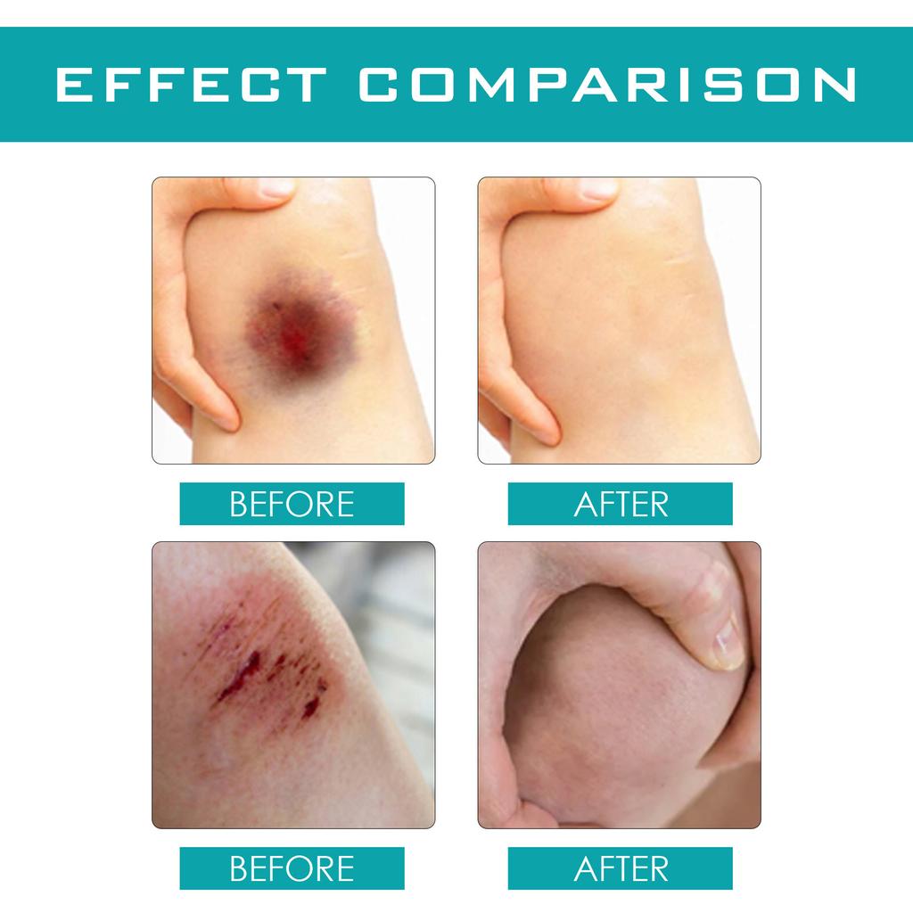 Жидкие капли для повязки; Жидкий шовный материал для ран; Клей для заживления ран, уменьшающий и изолирующий водонепроницаемый и воздухопроницаемый 30 мл