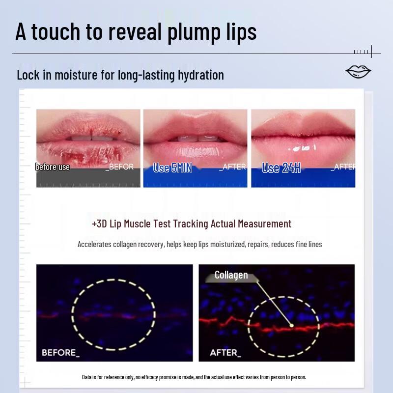 Moisturizing Lip Balm for Dry, Chapped Lips & Cheilitis